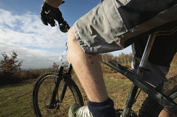 why do mountain bikers wear baggy shorts